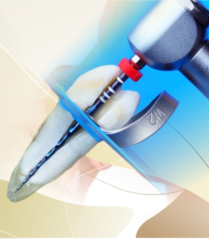 ENDODONTIA